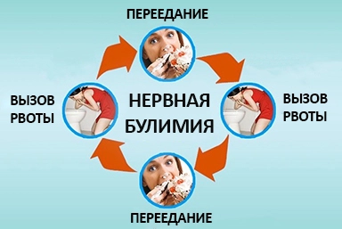 Лечение булимии в Кормиловке
